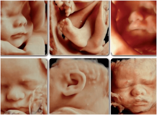 26 неделя беременности фото малыша и твои изменения