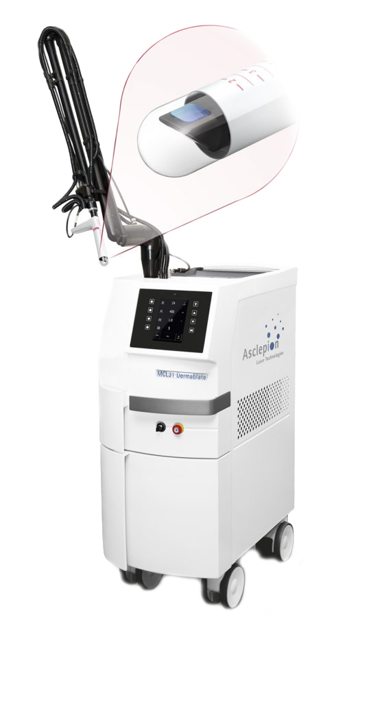 Эрбиевый лазер - Dermablate MCL 31