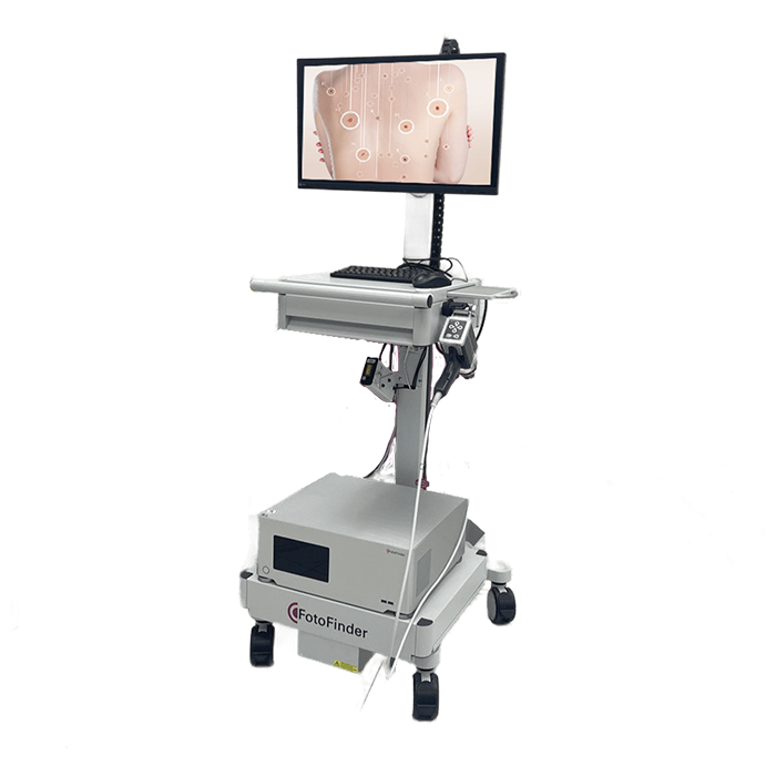 Цифровой дерматоскоп FotoFinder Bodystudio ATBM