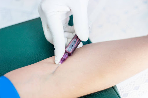 Ангиотензинпревращающий фермент (АПФ)