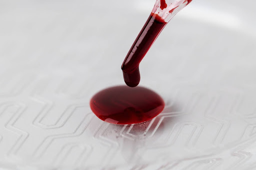 Анализ на суммарные антитела к туберкулезу