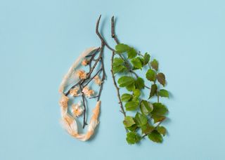 Атипичная пневмония 4