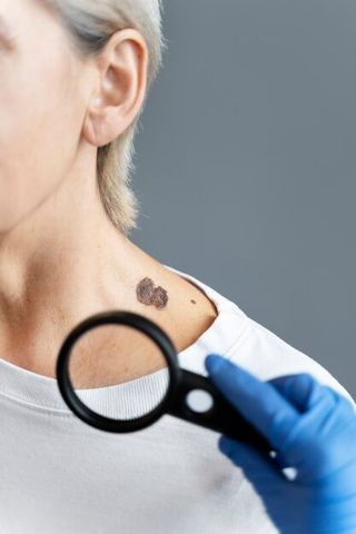 Врач дерматолог-онколог 3