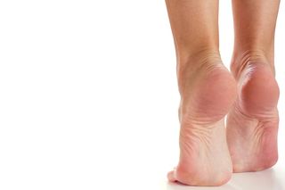 Пяточная шпора