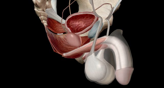 Сперматоцеле (киста яичка) 2