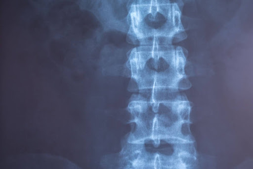 блокада под рентген-навигацией