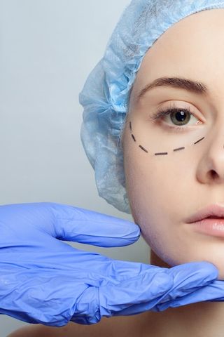 Круговая блефаропластика