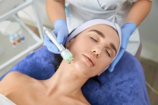 Удаление сосудистых звездочек на лице