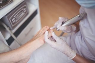 Лечение вросшего ногтя лазером в Москве