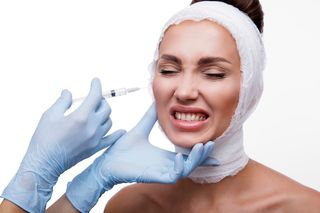 Эндоскопическая подтяжка средней части лица