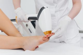 Удаление мозолей и натоптышей